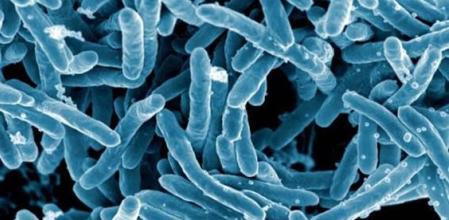 Imagen de microscopio de la bacteria Mycobacterium tuberculosis.