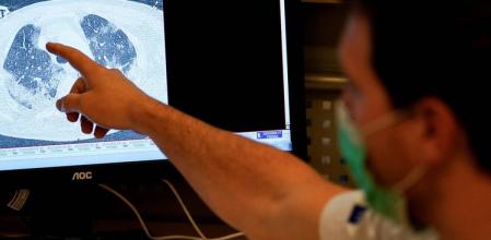 Radiografía en ordenador