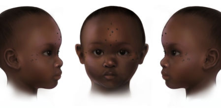 Reconstrucción de un tatuaje en la frente de una niña de tres años que vivió entre el 657 y el 855 d.C. y fue enterrada en Kulubnarti