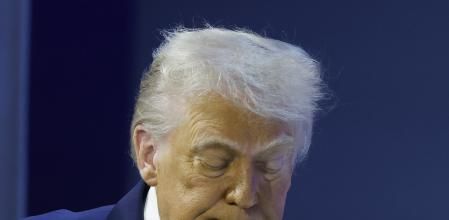 Trump ahir amb una de les taques a la mà que fan parlar