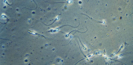 Identificados en el semen humano 42 compuestos químicos de uso cotidiano