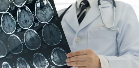 Choque de los médicos con Economía por los salarios que pagan las aseguradoras