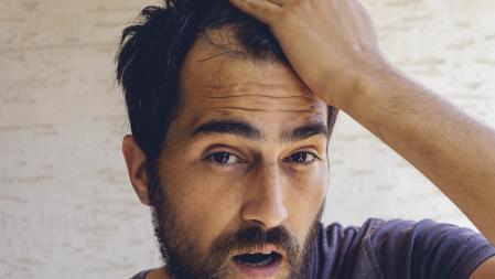 Caída de cabello en hombre