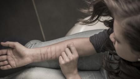 Young girl scratching arm in frustration self abusing.