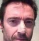 Hugh Jackman, con tiritas en la nariz tras ser intervenido de un cáncer de piel