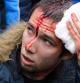 Un herido en los disturbios entre manifestantes prorrusos y activistas de la Maidan
