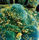 (FILES) In this undated handout image obtained July 15, 2020, courtesy of National Institute of Allergy and Infectious Diseases(NIH/NIAID), shows a colorized scanning electron micrograph of an apoptotic cell (blue/green) heavily infected with SARS-COV-2 virus particles (yellow), isolated from a patient sample, captured at the NIAID Integrated Research Facility (IRF) in Fort Detrick, Maryland. - US pharmaceutical company Eli Lilly's combination of two synthetic antibodies against Covid-19 reduced hospitalizations and deaths by 70 percent in high-risk patients with recent positive tests, the company said on January 26, 2021. "Bamlanivimab and etesevimab together have the potential to be an important treatment that significantly reduces hospitalizations and death in high-risk COVID-19 patients," Lilly's chief scientific officer Daniel Skovronsky said. (Photo by Handout / National Institute of Allergy and Infectious Diseases / AFP) / RESTRICTED TO EDITORIAL USE - MANDATORY CREDIT "AFP PHOTO /NATIONAL INSTITUTE OF ALLERGY AND INFECTIOUS DISEASES/HANDOUT " - NO MARKETING - NO ADVERTISING CAMPAIGNS - DISTRIBUTED AS A SERVICE TO CLIENTS