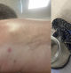 Un padre lleva a casa una serpiente venenosa para enseñársela a sus hijos y terminan en urgencias