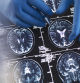 Un neurólogo revisa un cerebro observado con resonancia magnética