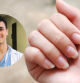 Ni falta de calcio ni de nutrientes: el porqué de las manchas en las uñas, según el dermatólogo Alfredo García