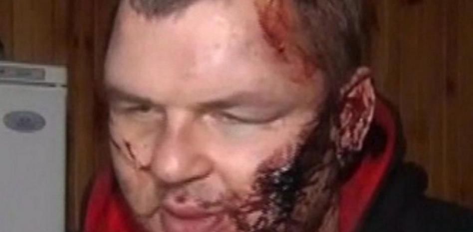 Un líder opositor ucraniano es liberado con signos de tortura