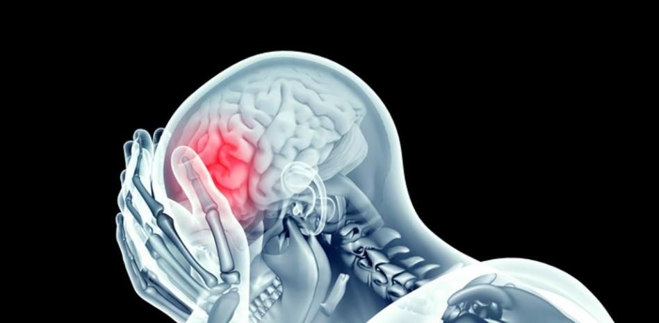 ¿Cuáles son los síntomas de un derrame cerebral como el que ha afectado a Jorge Javier Vázquez?