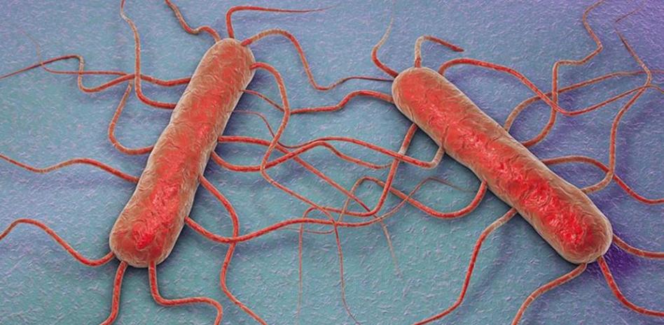 Listeriosis: ¿Qué es la bacteria listeria y cómo prevenir la infección?