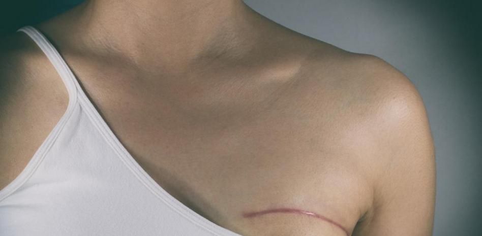 ¿Cómo puede enfrentarse uno a un diagnóstico de cáncer?