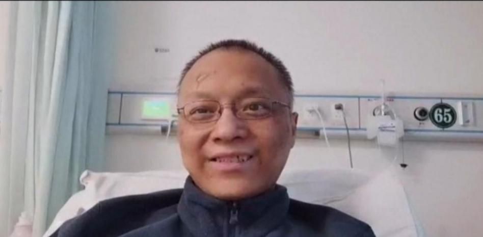 Habla uno de los médicos chinos al que se le ha vuelto la piel negra tras superar la Covid-19
