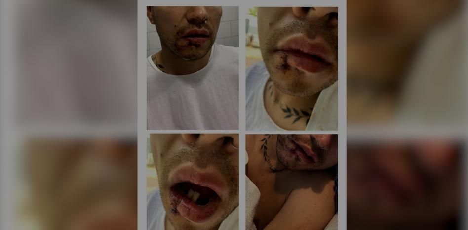 Denuncian una agresión múltiple en la playa del Somorrostro a dos parejas de gays