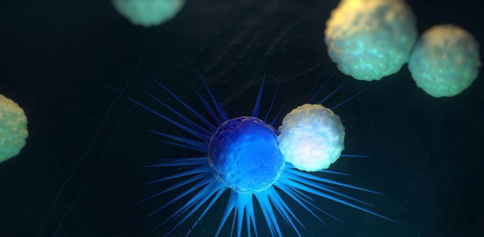 Mieloma múltiple, el segundo cáncer hematológico más frecuente entre la población española