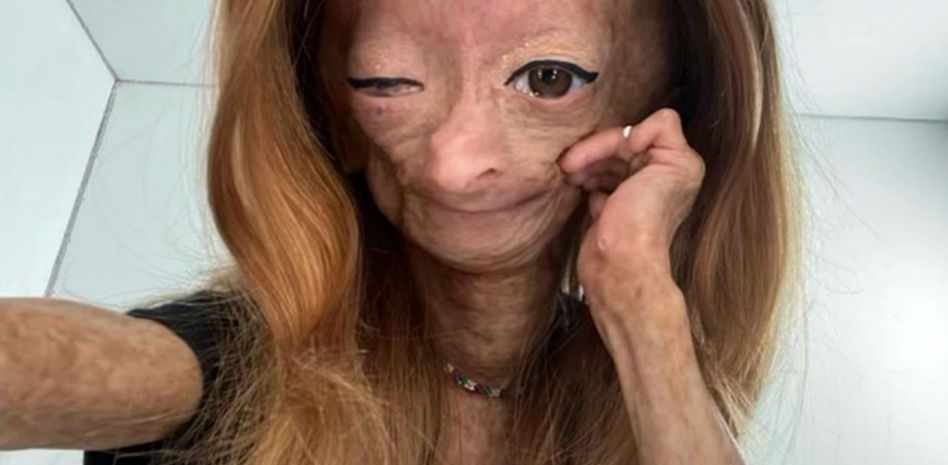 Muere Adalia Rose Williams, la youtuber que inspiró la película de Benjamin Button