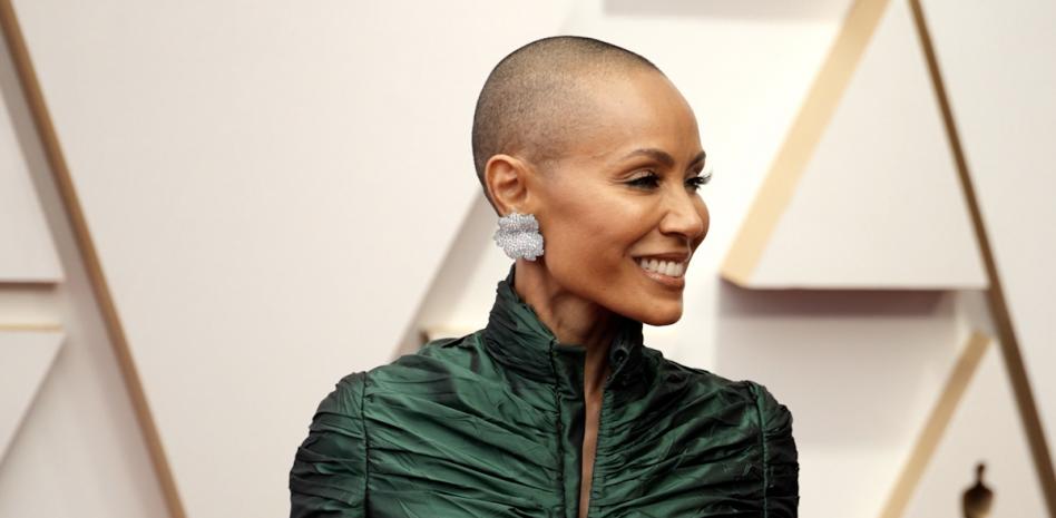 Qué es la alopecia femenina, la afección que padece Jada Pinkett Smith
