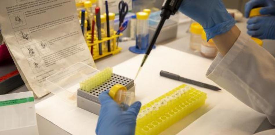 Madrid detecta 7 positivos y 22 casos posibles de viruela del mono en hombres jóvenes