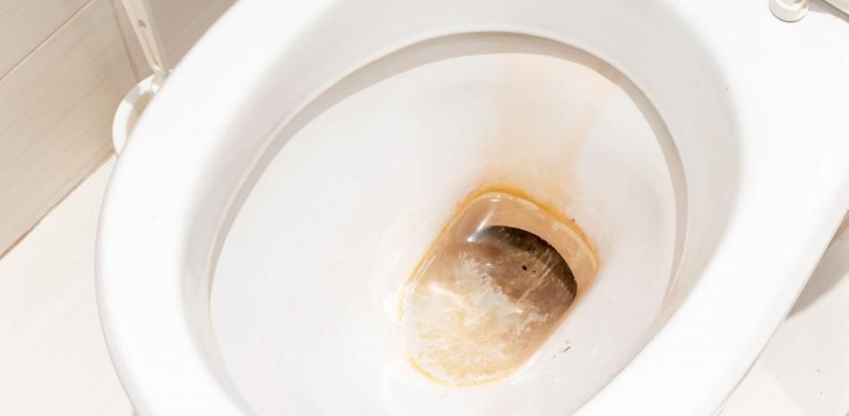 El truco infalible para arrancar las incrustaciones marrones de la taza del inodoro