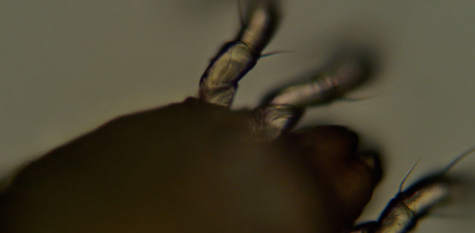El mundo microscópico del ácaro del polvo