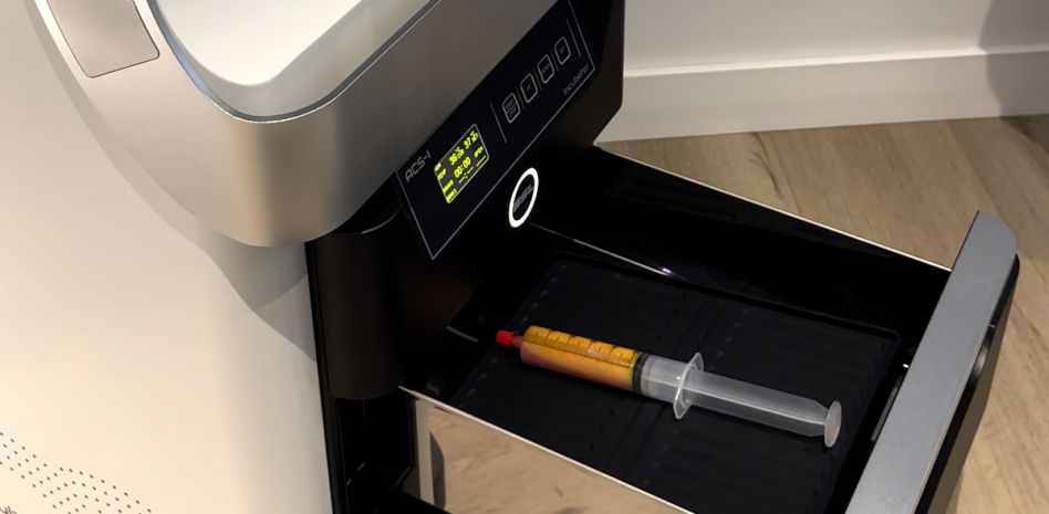 Rejuvenecimiento sin cirugía: así funciona el innovador tratamiento con grasa propia que revoluciona la medicina estética