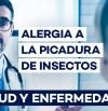 ¿Qué es la alergia a las picaduras de insectos y cómo tratarla eficazmente?