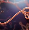 Qué es el ébola, cómo reconocer los síntomas y tratarlo