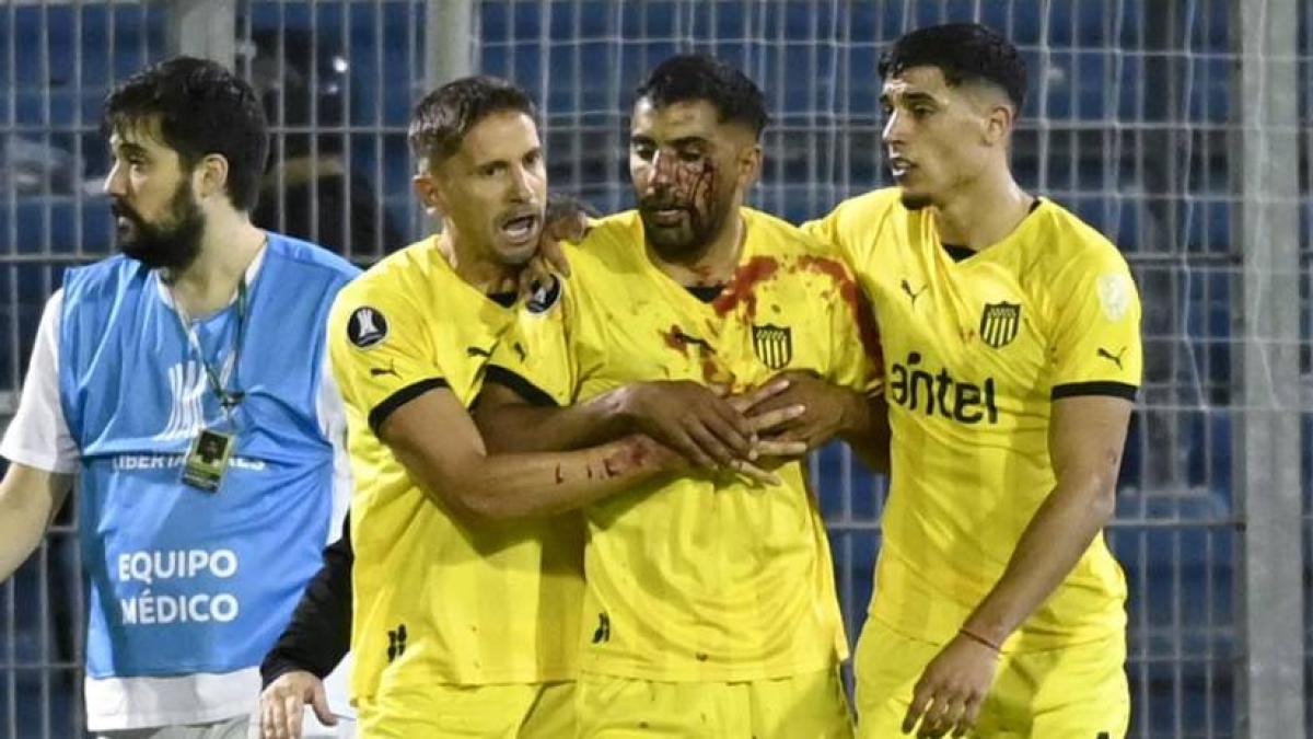 Maxi Oliveira recibe una pedrada en el rostro de un aficionado de Rosario Central