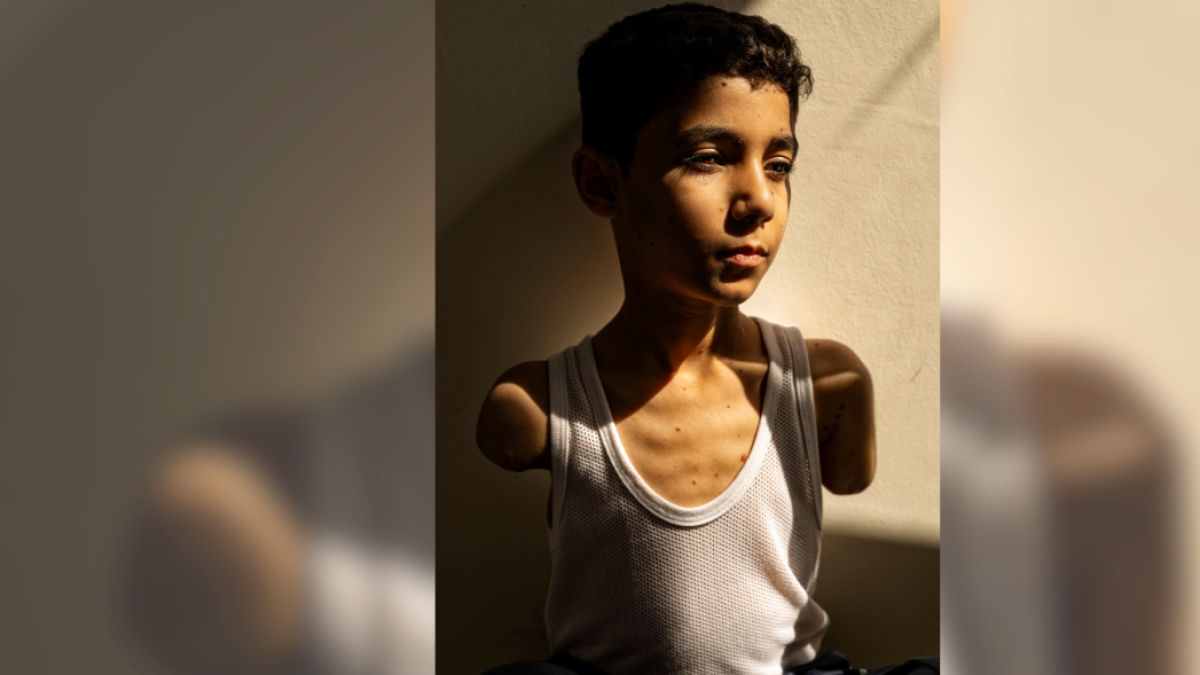 Una foto sobre secuelas de la guerra en niños gazatíes gana el World Press Photo global