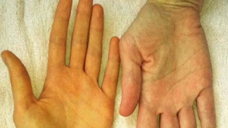 Gan - Cơ quan quan trọng trong cơ thể