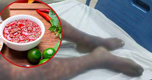 Sốc nhiễm khuẩn do liên cầu lợn: Nguyên nhân và biện pháp phòng tránh