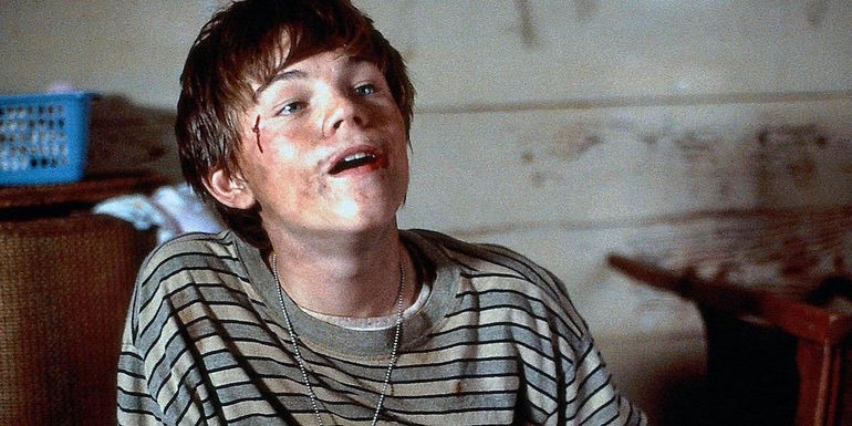 Arnie (Leonardo DiCaprio) covered in scratches in What's Eating Gilbert Grape