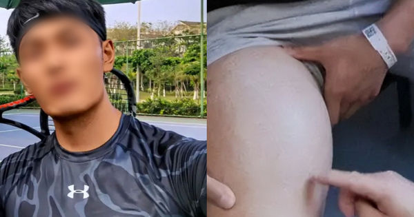 Chàng Mỹ Nam Đấu Tranh với Sự Tàn Khốc của Ung Thư: Hành Trình Đánh Thức Sức Mạnh Bên Trong