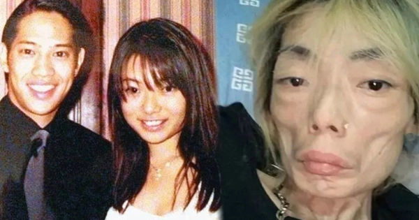 Đừng Lạm Dụng Thuốc Giảm Cân: Bài Học từ Câu Chuyện của Mỹ Nhân Hồng Kông