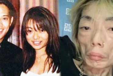 Đừng Lạm Dụng Thuốc Giảm Cân: Bài Học từ Câu Chuyện của Mỹ Nhân Hồng Kông