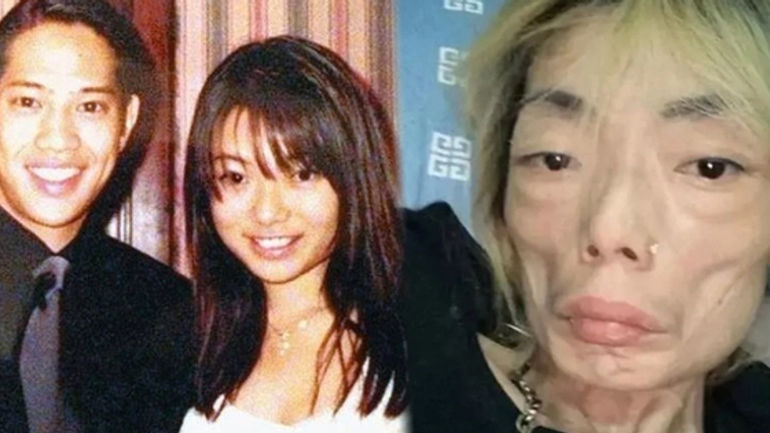 Đừng Lạm Dụng Thuốc Giảm Cân: Bài Học từ Câu Chuyện của Mỹ Nhân Hồng Kông