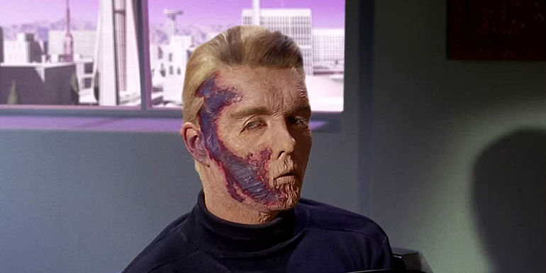 Sean Kenney as Pike in a wheelchair