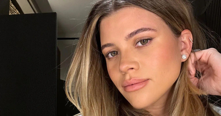 Sofia Richie's Pregnancy Acne Journey: Embracing Skincare Challenges