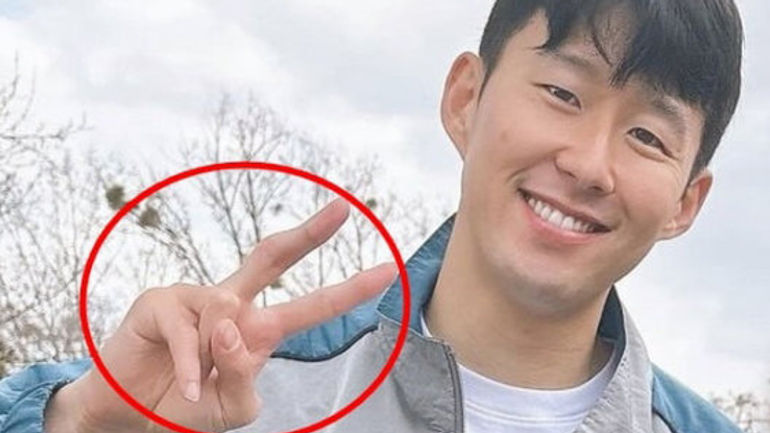 Câu chuyện đau lòng về ngón tay của Son Heung-min và Lee Kang-in