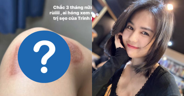 Hành trình hồi phục của Ngọc Trinh sau vết thương do tai nạn
