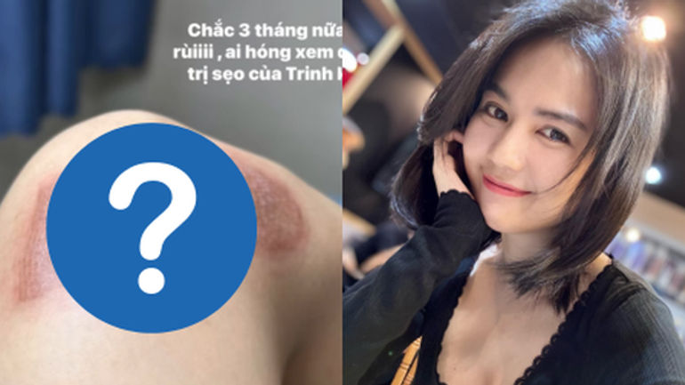 Hành trình hồi phục của Ngọc Trinh sau vết thương do tai nạn