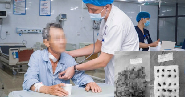 Bí mật về Ung Thư Dạ Dày: Đừng Bỏ Lỡ 3 Dấu Hiệu Quan Trọng