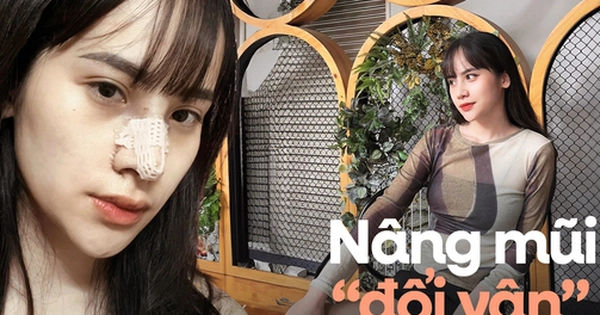 Hành Trình Đổi Diện Mạo: Chuyện Nâng Mũi của Cô Gái 9x