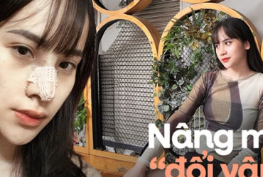 Hành Trình Đổi Diện Mạo: Chuyện Nâng Mũi của Cô Gái 9x