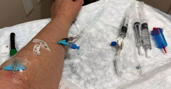 Ký Sinh Trùng Ấu Trùng Sán Nhái: Cơn Ác Mộng Trong Não