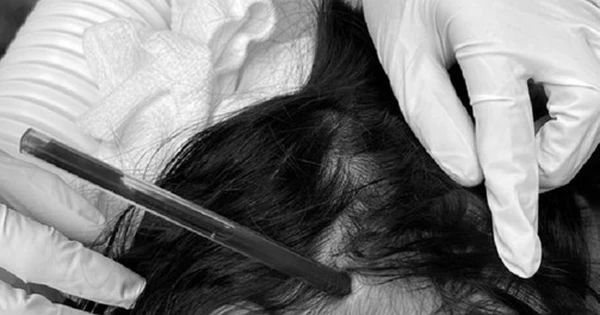 Những Bi kịch Bất Ngờ: Câu Chuyện của Bé Gái 4 Tuổi và Cây Bút Bi