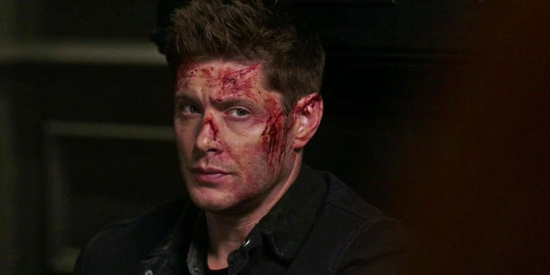 Dean Winchester Bloody In Supernatural