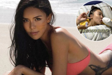 Nữ người mẫu gặp tai nạn đáng sợ mất tay trái, bài viết đầu tiên gây ngưỡng mộ hàng nghìn netizen